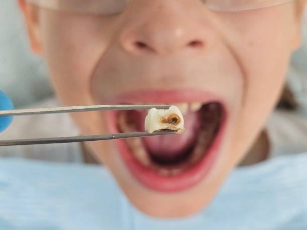Best Emergency Care for Gum Disease in Russell, GA